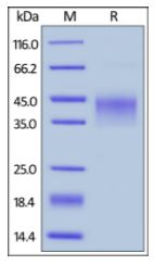 Human LAP (TGF-beta 1), His Tag on SDS-PAGE under reducing (R) condition. The gel was stained overnight with Coomassie Blue. The purity of the protein is greater than 95%.